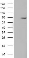 HEK293T cells were transfected with the pCMV6-ENTRY control (Left lane) or pCMV6-ENTRY EPM2AIP1 (Right lane) cDNA for 48 hrs and lysed
