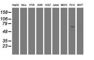 Western blot analysis of extracts (35ug) from 9 different cell lines by using anti-EPM2AIP1 monoclonal antibody