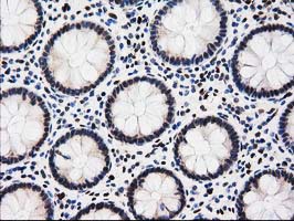 m12427 2 anti epm2aip1 mouse monoclonal antibody clone id oti1f11 ihc testing 4