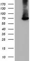HEK293T cells were transfected with the pCMV6-ENTRY control (Left lane) or pCMV6-ENTRY EPM2AIP1 (Right lane) cDNA for 48 hrs and lysed