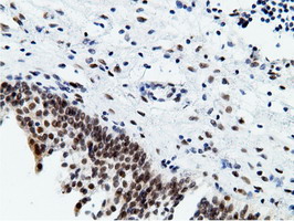 m12427 anti epm2aip1 mouse monoclonal antibody clone id oti2g3 ihc testing 10