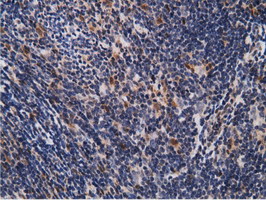 m12427 anti epm2aip1 mouse monoclonal antibody clone id oti2g3 ihc testing 11