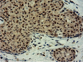 m12427 anti epm2aip1 mouse monoclonal antibody clone id oti2g3 ihc testing 12