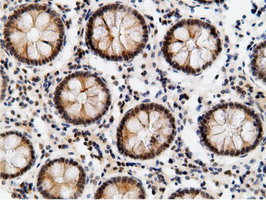 m12427 anti epm2aip1 mouse monoclonal antibody clone id oti2g3 ihc testing 13