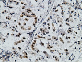m12427 anti epm2aip1 mouse monoclonal antibody clone id oti2g3 ihc testing 14