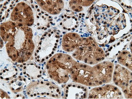m12427 anti epm2aip1 mouse monoclonal antibody clone id oti2g3 ihc testing 15