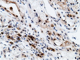 m12427 anti epm2aip1 mouse monoclonal antibody clone id oti2g3 ihc testing 16