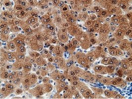 m12427 anti epm2aip1 mouse monoclonal antibody clone id oti2g3 ihc testing 17