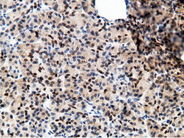 m12427 anti epm2aip1 mouse monoclonal antibody clone id oti2g3 ihc testing 4