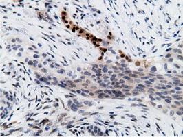m12427 anti epm2aip1 mouse monoclonal antibody clone id oti2g3 ihc testing 5