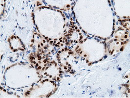 m12427 anti epm2aip1 mouse monoclonal antibody clone id oti2g3 ihc testing 6