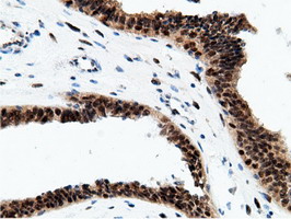 m12427 anti epm2aip1 mouse monoclonal antibody clone id oti2g3 ihc testing 7