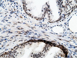 m12427 anti epm2aip1 mouse monoclonal antibody clone id oti2g3 ihc testing 8