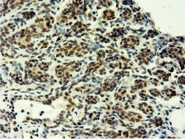 m12427 anti epm2aip1 mouse monoclonal antibody clone id oti2g3 ihc testing 9