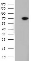 HEK293T cells were transfected with the pCMV6-ENTRY control (Left lane) or pCMV6-ENTRY EPM2AIP1 (Right lane) cDNA for 48 hrs and lysed
