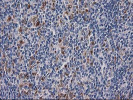 m12432 1 anti atp6v1f mouse monoclonal antibody clone id oti5f10 ihc testing 3
