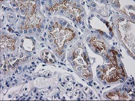 m12432 1 anti atp6v1f mouse monoclonal antibody clone id oti5f10 ihc testing 4