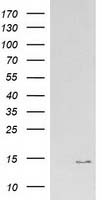 m12432 1 anti atp6v1f mouse monoclonal antibody clone id oti5f10 wb testing 1