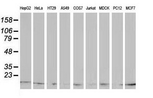 m12432 1 anti atp6v1f mouse monoclonal antibody clone id oti5f10 wb testing 2