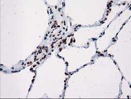 m12432 anti atp6v1f mouse monoclonal antibody clone id oti1b8 ihc testing 10