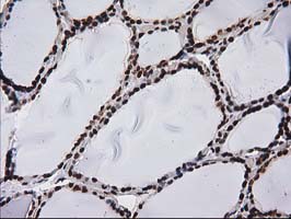 m12432 anti atp6v1f mouse monoclonal antibody clone id oti1b8 ihc testing 2