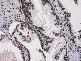 m12432 anti atp6v1f mouse monoclonal antibody clone id oti1b8 ihc testing 3
