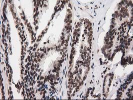 m12432 anti atp6v1f mouse monoclonal antibody clone id oti1b8 ihc testing 4