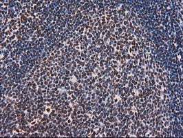 m12432 anti atp6v1f mouse monoclonal antibody clone id oti1b8 ihc testing 5