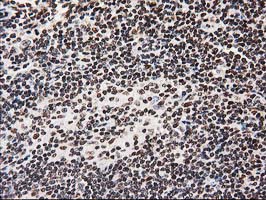 m12432 anti atp6v1f mouse monoclonal antibody clone id oti1b8 ihc testing 6