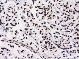 m12432 anti atp6v1f mouse monoclonal antibody clone id oti1b8 ihc testing 7