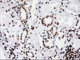 m12432 anti atp6v1f mouse monoclonal antibody clone id oti1b8 ihc testing 8
