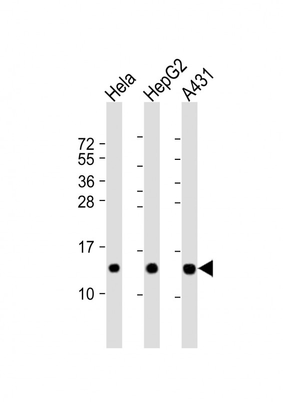 m12461 anti ndufb3 antibody n term wb testing 2