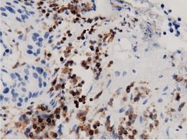m12463 anti arhgap25 mouse monoclonal antibody clone id oti12g4 ihc testing 10