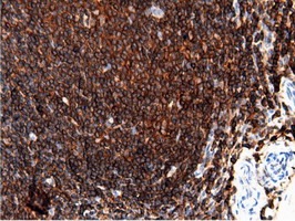 m12463 anti arhgap25 mouse monoclonal antibody clone id oti12g4 ihc testing 11