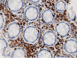 m12463 anti arhgap25 mouse monoclonal antibody clone id oti12g4 ihc testing 12