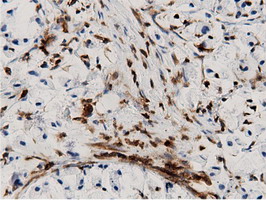 m12463 anti arhgap25 mouse monoclonal antibody clone id oti12g4 ihc testing 13