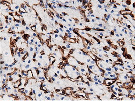 m12463 anti arhgap25 mouse monoclonal antibody clone id oti12g4 ihc testing 14