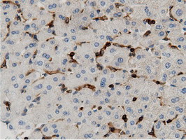 m12463 anti arhgap25 mouse monoclonal antibody clone id oti12g4 ihc testing 15