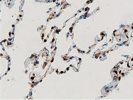 m12463 anti arhgap25 mouse monoclonal antibody clone id oti12g4 ihc testing 16