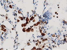m12463 anti arhgap25 mouse monoclonal antibody clone id oti12g4 ihc testing 3