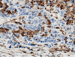 m12463 anti arhgap25 mouse monoclonal antibody clone id oti12g4 ihc testing 4