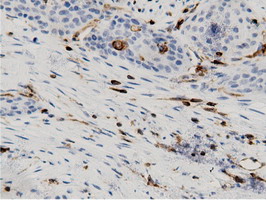 m12463 anti arhgap25 mouse monoclonal antibody clone id oti12g4 ihc testing 5