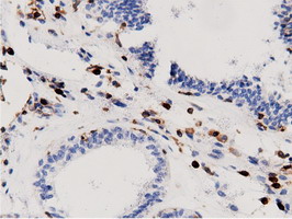 m12463 anti arhgap25 mouse monoclonal antibody clone id oti12g4 ihc testing 6