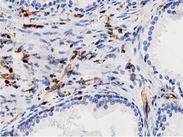 m12463 anti arhgap25 mouse monoclonal antibody clone id oti12g4 ihc testing 7