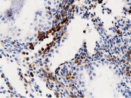 m12463 anti arhgap25 mouse monoclonal antibody clone id oti12g4 ihc testing 8