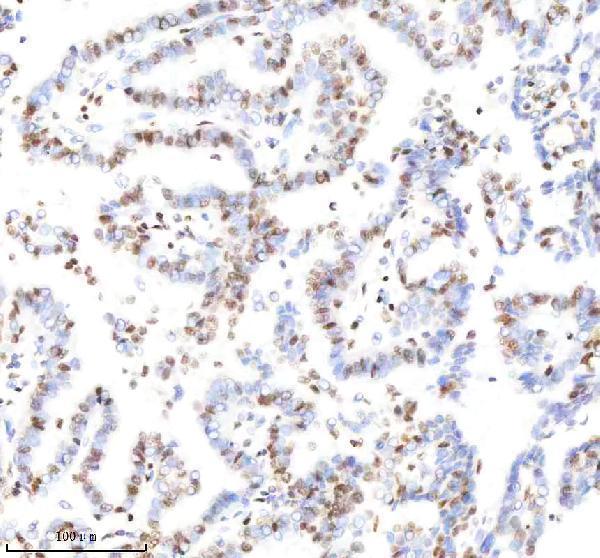 m12477 25 histone_h3 primary antibodies ihc testing 2
