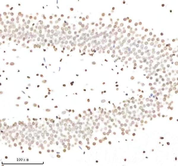 m12477 25 histone_h3 primary antibodies ihc testing 4