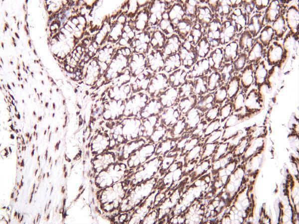 m12477 27 hist1h3a primary antibodies ihc testing 2