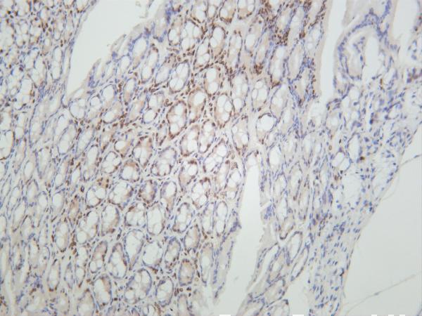 m12477 28 hist1h3a primary antibodies ihc testing 1
