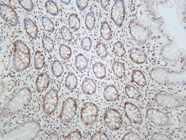 m12477 28 hist1h3a primary antibodies ihc testing 3